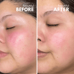 Before & After image